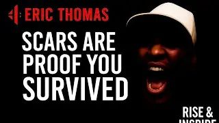 ERIC THOMAS - SCARS ARE PROOF YOU SURVIVED | RISE & INSPIRE