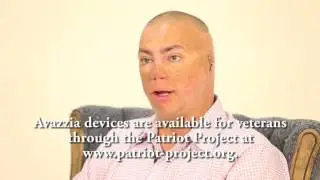 Scar tissue therapy help Shilo Harris, Staff Sergeant, Ret.