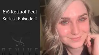 6% Pure Retinol Peel | Episode 2!