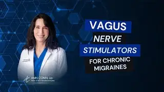 Vagus Nerve Stimulators For Chronic Migraines