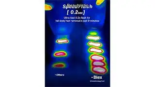 Blex Laser Hair Removal Review: Fast, Painless, Permanent Results in 2 Weeks!