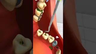 Doctor 🩺 cleaning for Kids 😆 #shorts