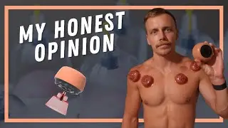 ZDeer Cupping Therapy Set Review | Is It Worth It?