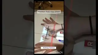 folio view x-Ray #anatomy #sciecne@Drashishradiogarpyer
