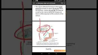 The Defecation reflex