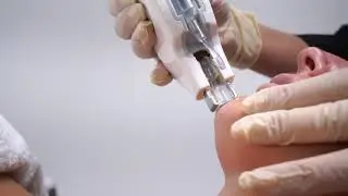 #MesoSkin Needle-Free Mesotherapy Device