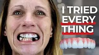 Costly Dental Solutions to Avoid