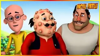 மோட்டு பட்லு - டைம்பாஸ் எபிசோட் 93 | Motu Patlu - Timepass Episode 93