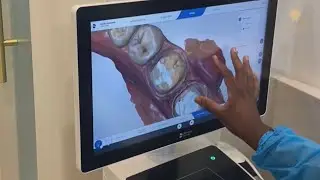 CEREC Machine - Get Your Crowns Designed in 1 Day!