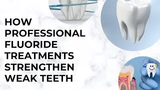 How Professional Fluoride Treatments Strengthen Weak Teeth | Shrouf Dental House