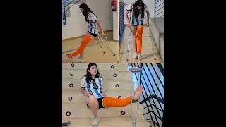 Soccer player CLC &middot; high pain &middot; crutching &middot; sock on-off (full video on comments)
