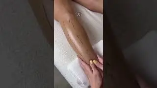 #physiotherapy #swollenlegs #legswelling #myleg #massage #massagetherapy #massagetechniques #trainer
