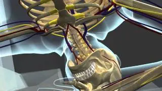 3D Accident Animation - Stair Fall at Construction Site
