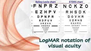 LogMAR notation of visual acuity