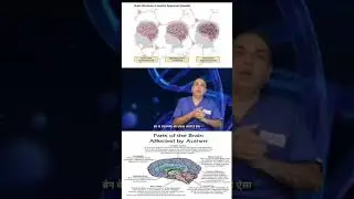 Autism is a condition that helps in the brain development of children #drrksingh