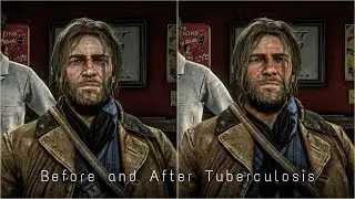 Посмотрите на Артура до и после туберкулеза &mdash; как сильно он изменился. 8K Ultra HD, HDR, RDR2