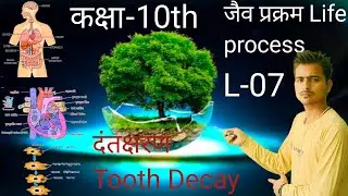 Class 10th Science chap-05 जैव प्रक्रम// दंतक्षरण Tooth Decay//L-07 by P.K Sir