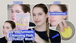 I Tried the Viral Kojic Acid & Turmeric Cleansing Pads You&rsquo;ve Seen All Over TikTok | Take My Money