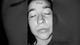 Giga Chick&hellip; yes she asked me to make this.😆 #wisdomteeth #memes