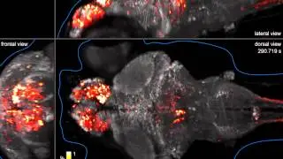 Whole-brain imaging of neuronal activity (visualization B, projections)