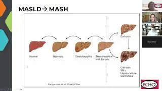 September 2025 Treating the Disease of Obesity ECHO Program - Pediatric Obesity