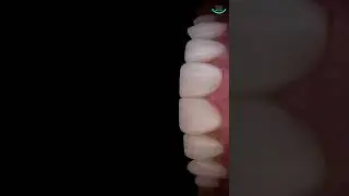 Smile Kochi Dental Clinic +91 7999995339 PALARIVATTOM,KADAVANTHARA,EDAPPALLY, KAKKANAD.