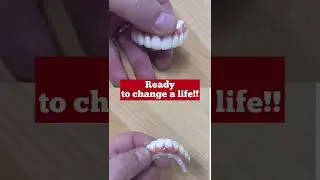 ALL ON 4 Zirconia Bridges are Beautiful in the right hands!!❤️
