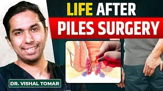 Life After Piles Surgery | Precautions | Diet | Recovery - Dr. Vishal Tomar