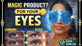 Magic Product for your EYES 👀 Gel eye pack by BoldFit | For Puffiness Eyes, Red eyes, Dark circles