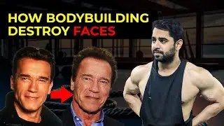 Facial Side Effects of Anabolic Steroid | Arnold Schwarzenegger