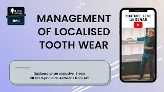 Management of Tooth Wear - Dr Banerji (ADE)