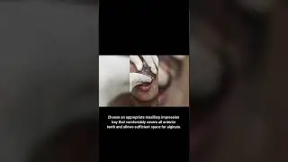 Fastest Crown Prep & Impression Hack 😲#crownpreparation #alginateimpression #dentalstonemodel#viral 
