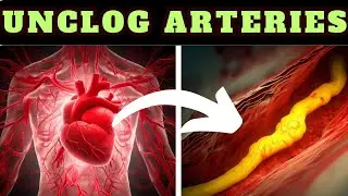 5 Best Vegetables To Clean Arteries And Prevent Heart Attacks