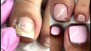 C&oacute;mo hacer PedicuraTutorial | How To Do Pedicure Foot Transformation Pedicure Compilation!