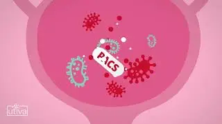 Cranberry Juice, is it good for UTIs?