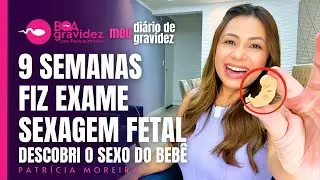 DESCOBRI O SEXO DO MEU BEBÊ COM 9 SEMANAS | Diário de Gravidez - 9 Semanas de Gestação