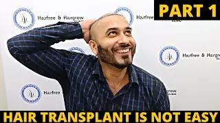 Finally Removed All my Hair | First day of hair transplant | Born Creator