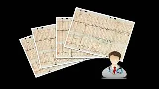 FetalCare: A Mobile Cardiotocograph System