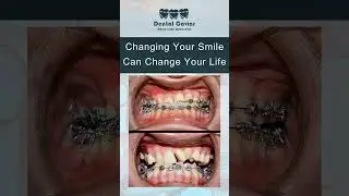 Best Dentist in Multan/Best Dental Clinic in Multan