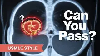 Can You Pass This Abdominal Anatomy Quiz? 🧠 Medical Student Challenge!