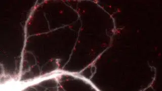 Single molecule imaging of SARS-CoV-2 spike protein (red) on a live brain cell