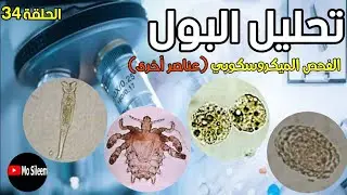 Urinalysis 34 microscopic ex (Fat bodies & Artifacts)