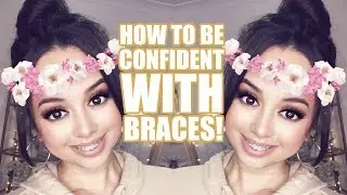 HOW TO BE CONFIDENT WITH BRACES!