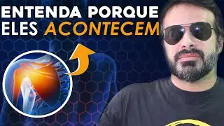 ACIDENTES ANAT&Ocirc;MICOS DA ESC&Aacute;PULA: N&Atilde;O DECORE, ENTENDA PORQUE ELES ACONTECEM
