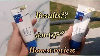 Mistine acne clear face wash review||Honest review||skincare