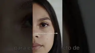 &iquest;Qu&eacute; es la Cantopexia? #cirugiaocular #ojos #saludocular #estetica #cl&iacute;nicacarriazo