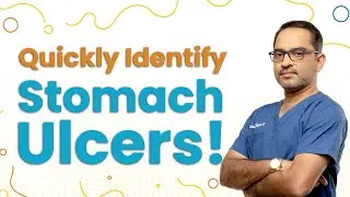 How to know if you have Stomach Ulcer | Dr. Deepak Subramanian
