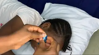 Soothing ASMR Ear Nitpicking | Tingles & Deep Sleep 😴 