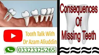 Consequences of missing teeth#missingtooth #missing #tilting #dentist #sensitivity #cavity