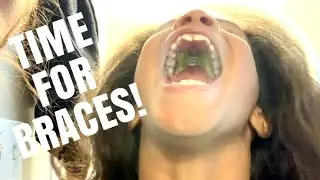 INDIA GETS A METAL MOUTH! | WE GO ON TV TO TALK ABOUT OUR EXPERIENCE WITH THE POLICE